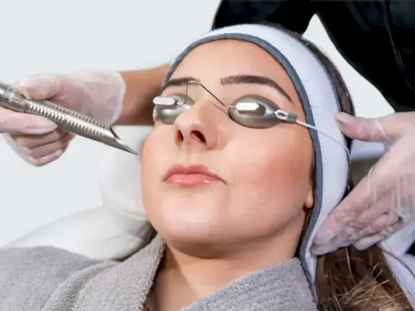 Fraksiyonel Erbium Yag Lazerler