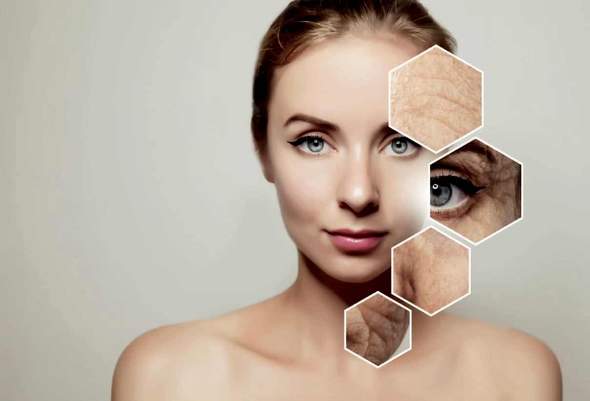 Jalupro V-Lift Ankara